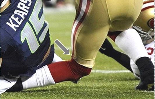 acl-reconstruction-surgery