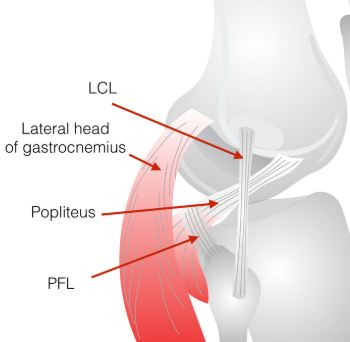ligament-lcl-tear