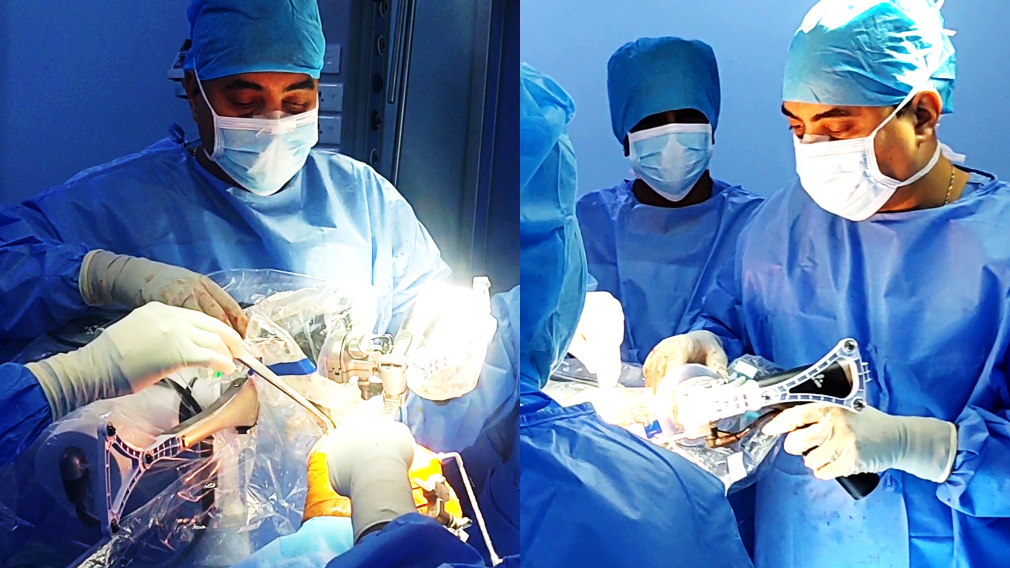 robotic-knee-replacement